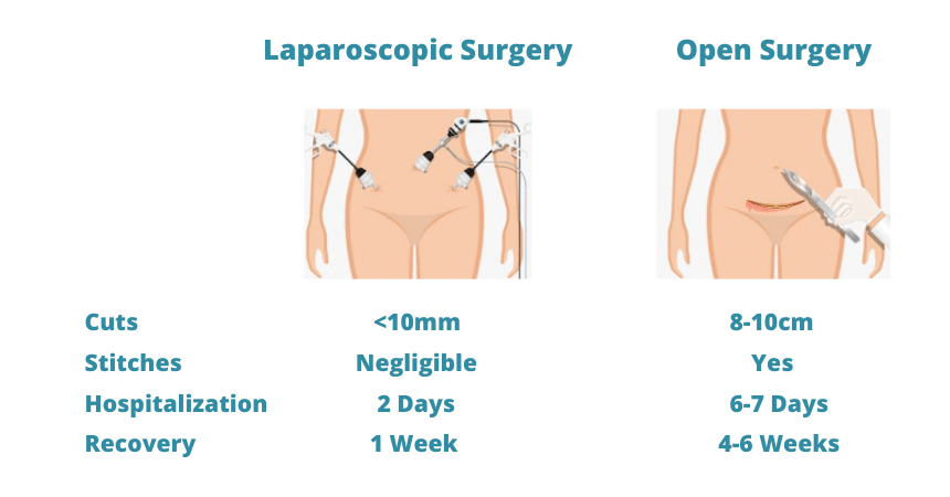 hospital for Laparoscopic Hysterectomy Surgery